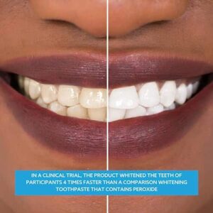 GO SMILE Teeth Whitening Gel, 3.4 OZ. - Image 11