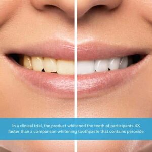 GO SMILE Teeth Whitening Gel, 3.4 OZ. - Image 8