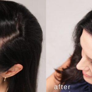 LUXE Hair Thickening Fibers - CONFIDENCE IN A JAR ? 2 Months+ Supply! ? Hypoallergenic, Dermatologist Tested ? Multiple Colors Available (Dark Brown) - Image 3