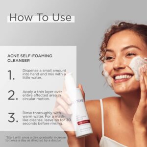 Glytone Acne Self Foaming Cleanser - With 0.5% Salicylic Acid For Mild Acne - Non-Comedogenic - Non-Irritating - 6.1 fl. oz. - Image 4