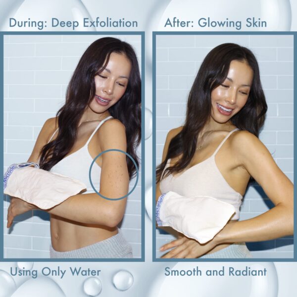 MicrodermaMitt Deep Exfoliating Mitt for Shower ? Dead Skin Remover & Exfoliator Body Scrubber - Keratosis Pilaris ? Premium Quality for Smooth & Clea - Image 5