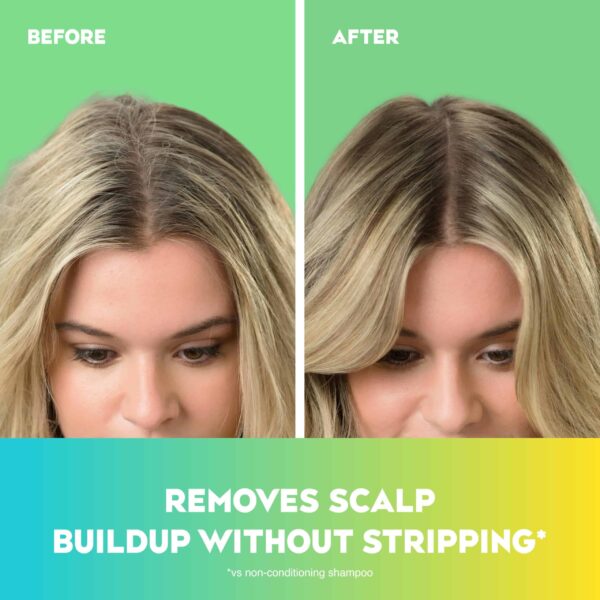 OGX Extra Strength Refreshing Scalp + Teatree Mint Conditioner, Invigorating Conditioner with Tea Tree & Peppermint Oil & Witch Hazel, Paraben-Free, S - Image 2